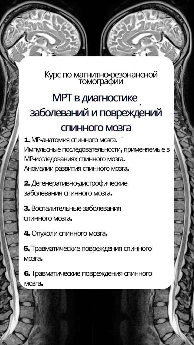 МРТ в диагностике заболеваний и повреждений спинного мозга — kurs muqovasi
